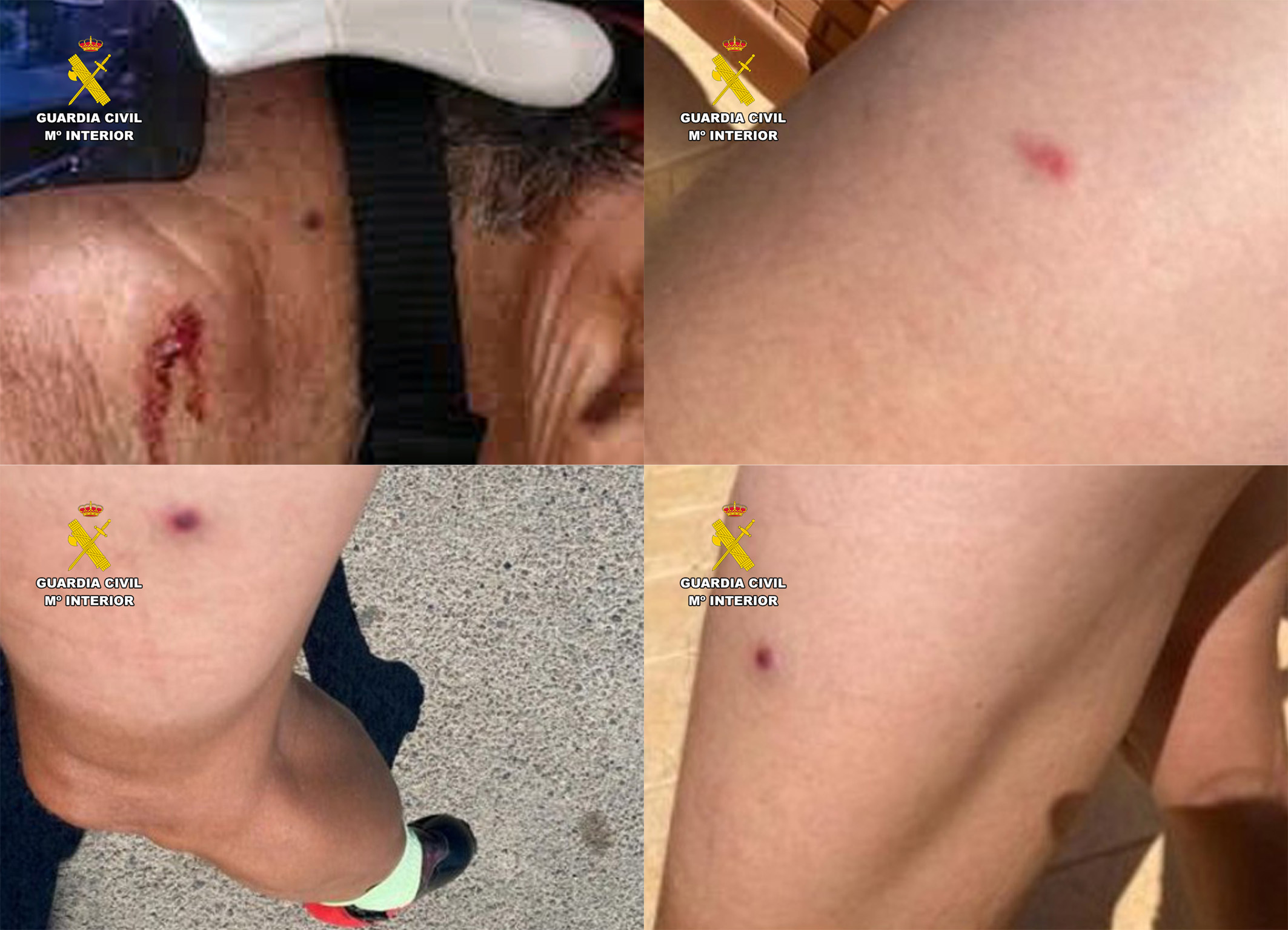 20231123 INVESTIGADOS LESIONES A CICLISTAS AIRSOFT TORREAGUERA cuatro