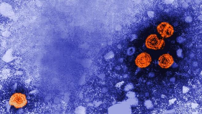 imagen de microscopia electronica